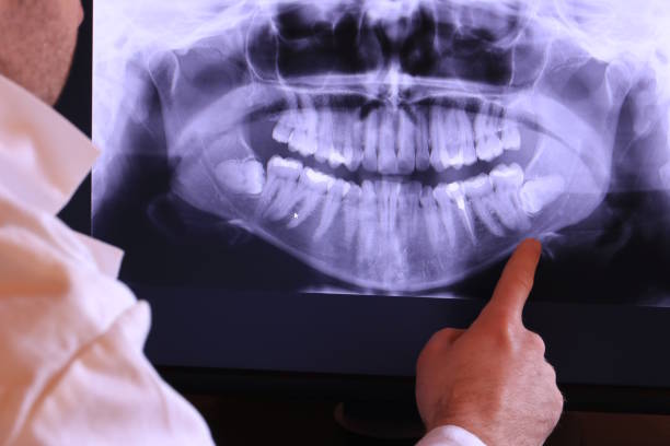 Best Broken Tooth Emergency  in Fort Dodge, IA